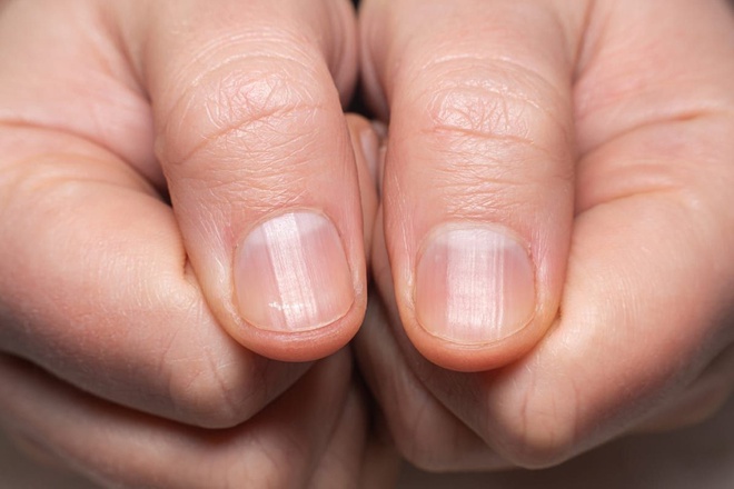 Các bệnh về da và móng tay - là một trong các biến chứng khác của bệnh tiểu đường