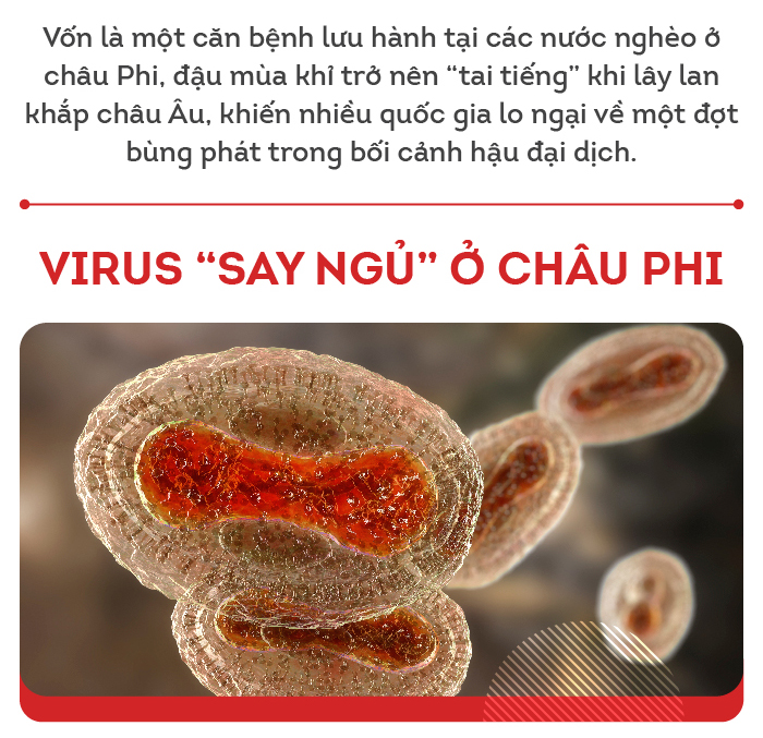 Sự trỗi dậy của bệnh đậu mùa khỉ: Nguồn gốc virus và cách phòng tránh 2